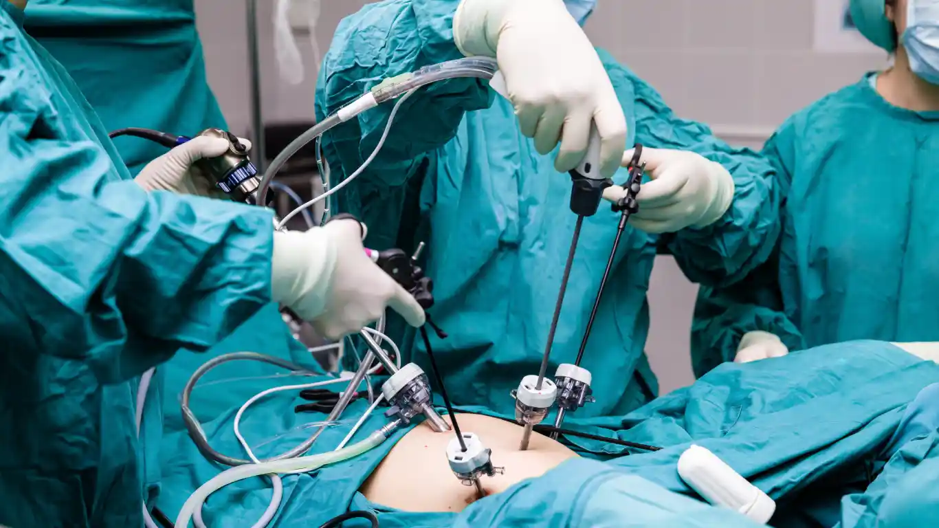 Cirugía de abdomen en Nuevo León