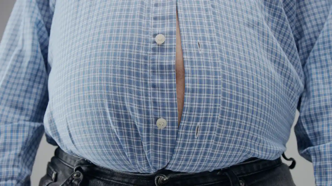 Cirugía para obesidad mórbida en Nuevo León