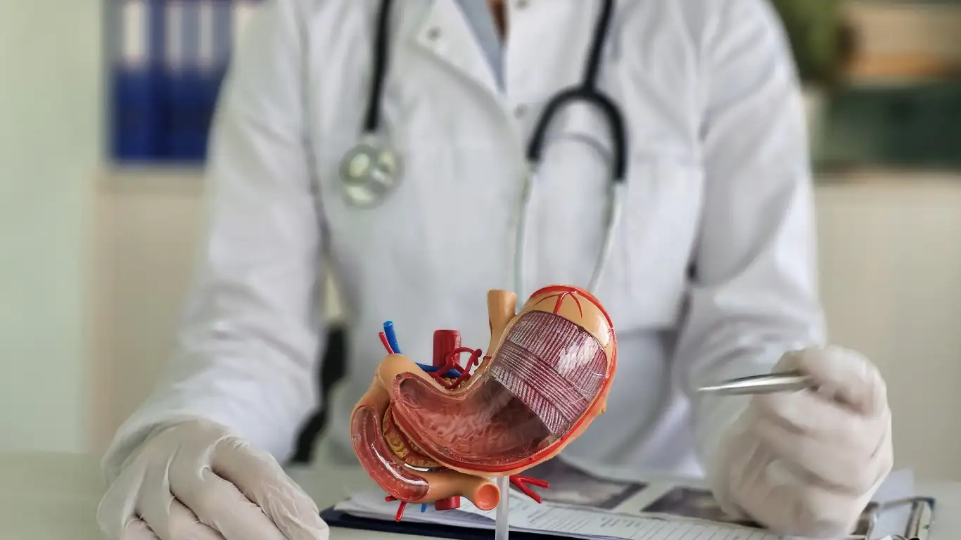 Derivación biliopancreática en Nuevo León