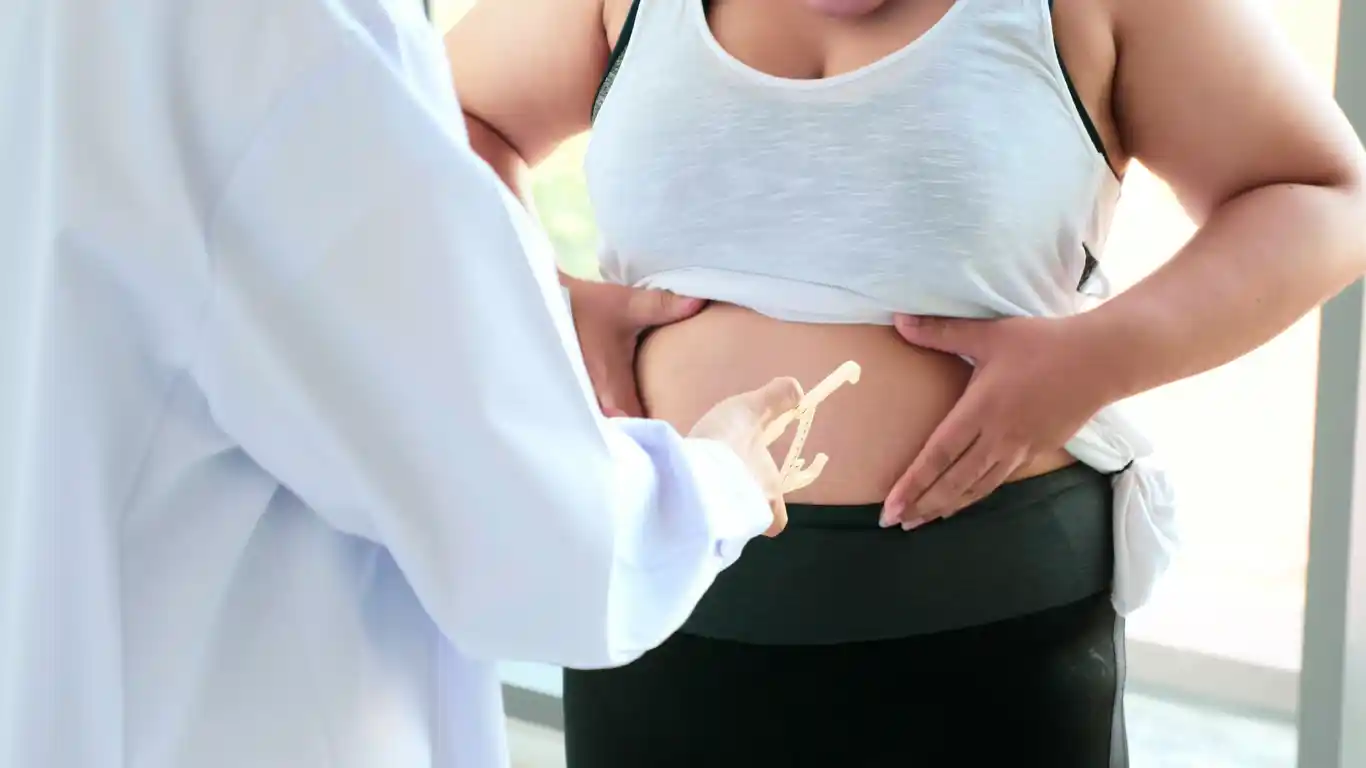 Especialista en cirugía de obesidad en Nuevo León