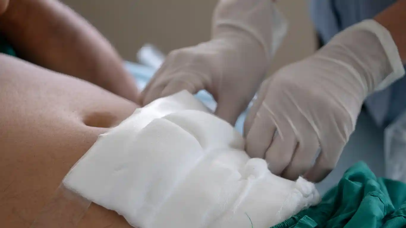 Seguimiento postoperatorio bariátrico en Nuevo León