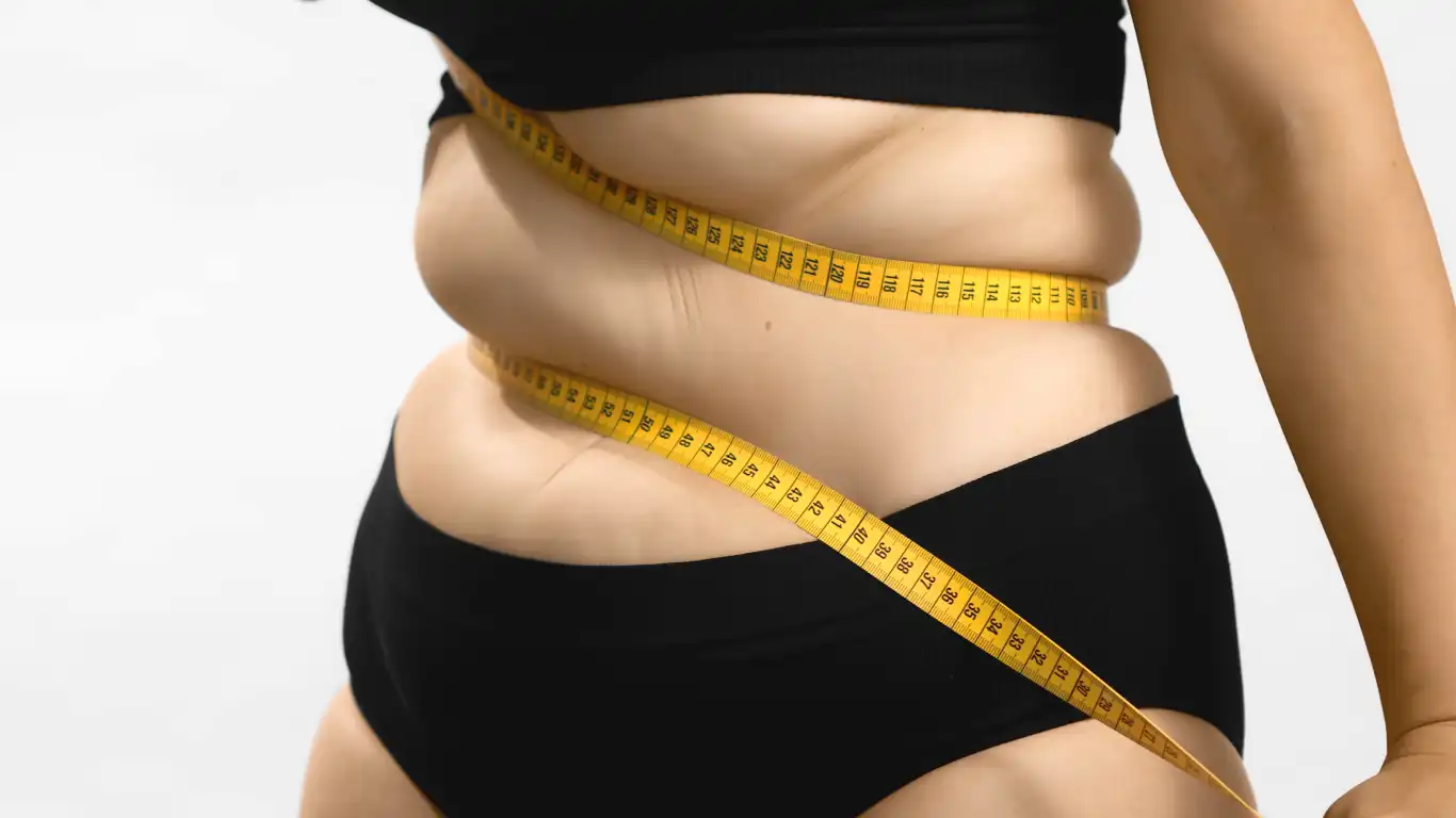 Tratamiento de obesidad con cirugía en Nuevo León