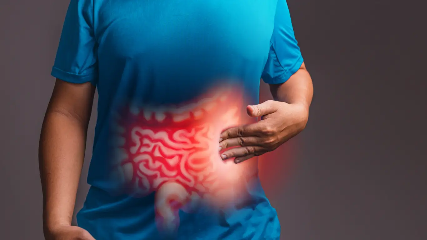 Tratamiento quirúrgico de apendicitis en Nuevo León